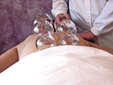 Cupping on the back can be used to relieve muscle pain or to ward off the onset of a cold. Despite the strange way it looks, cupping feels good and is deeply relaxing.